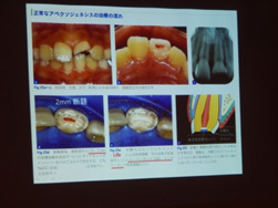 2017年3月22日　スタディグループ火曜会例会に参加