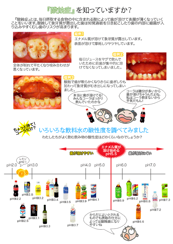 酸蝕症を知っていますか？